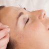 Can Face Acupuncture Really Make You Look Younger?