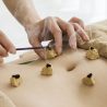 Moxibustion (艾灸) in Chinese Medicine